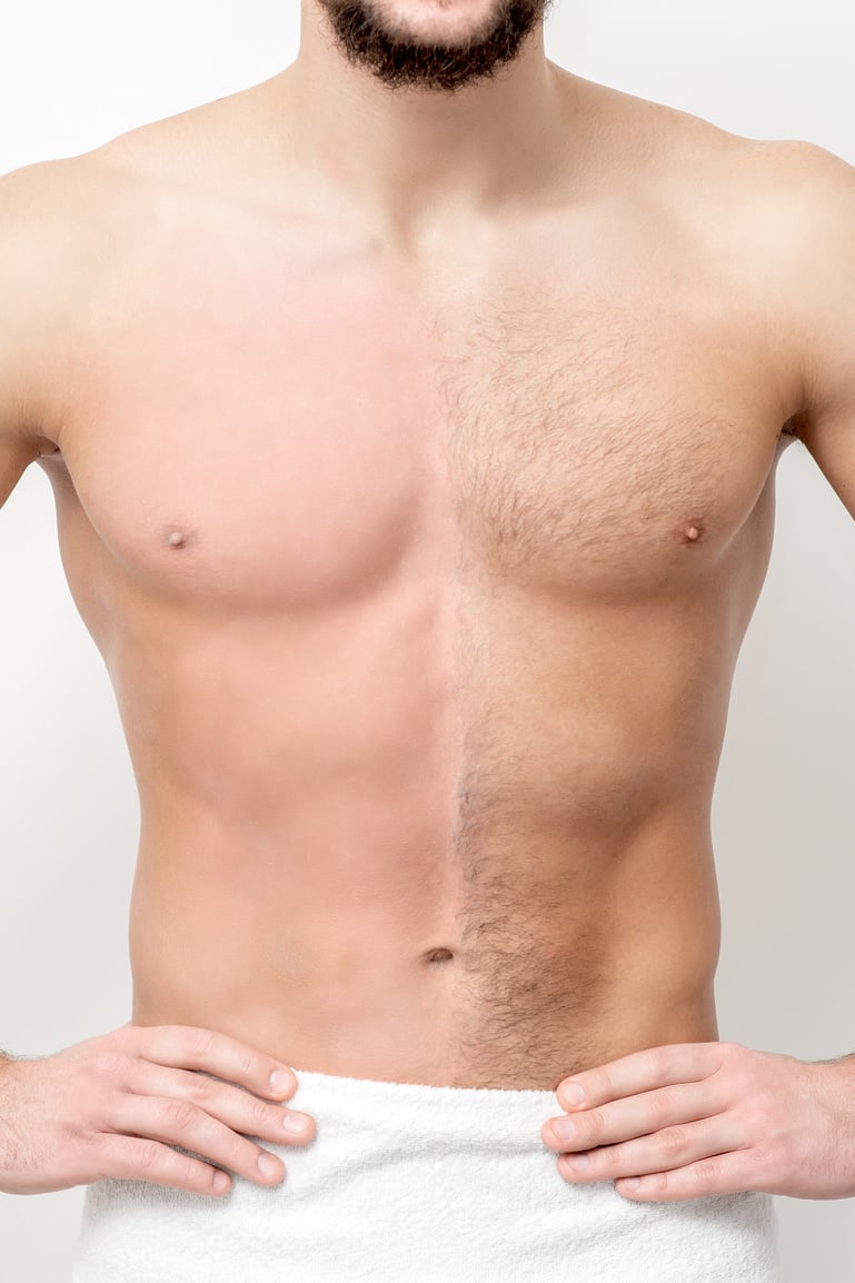 Man with Bare-Chested before and after Waxing Hair